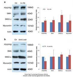 Anti-Transgelin antibody used in Western Blot (WB). GTX113561