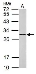Anti-VEGFC antibody used in Western Blot (WB). GTX113574
