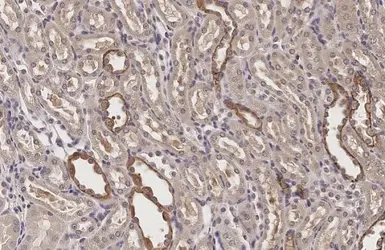 Anti-VEGFC antibody used in IHC (Paraffin sections) (IHC-P). GTX113574