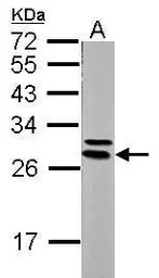 Anti-14-3-3 epsilon antibody [N2C3] used in Western Blot (WB). GTX113576