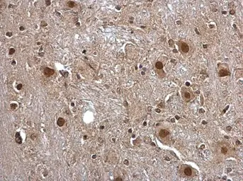 Anti-Pirin antibody used in IHC (Paraffin sections) (IHC-P). GTX113584