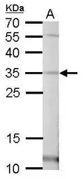 Anti-Pirin antibody used in Western Blot (WB). GTX113584