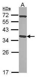 Anti-Pirin antibody used in Western Blot (WB). GTX113584