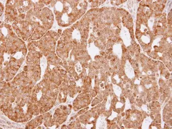 Anti-AKR1C3 antibody [N1C1] used in IHC (Paraffin sections) (IHC-P). GTX113586