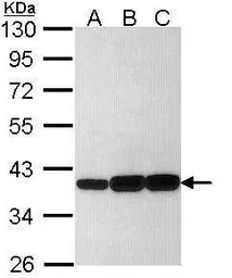Anti-AKR1C3 antibody [N1C1] used in Western Blot (WB). GTX113586