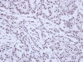 Anti-SAE1 antibody used in IHC (Paraffin sections) (IHC-P). GTX113602