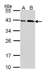 Anti-SAE1 antibody used in Western Blot (WB). GTX113602