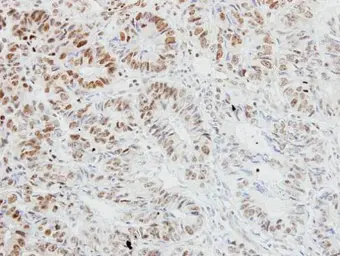 Anti-CIKS antibody [C1C3] used in IHC (Paraffin sections) (IHC-P). GTX113615