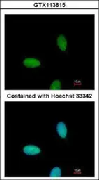 Anti-CIKS antibody [C1C3] used in Immunocytochemistry/ Immunofluorescence (ICC/IF). GTX113615