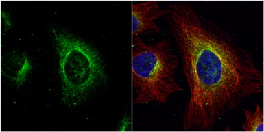 Anti-ASL antibody used in Immunocytochemistry/ Immunofluorescence (ICC/IF). GTX113629
