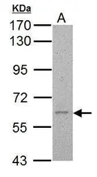 Anti-Cav beta 4 antibody used in Western Blot (WB). GTX113638
