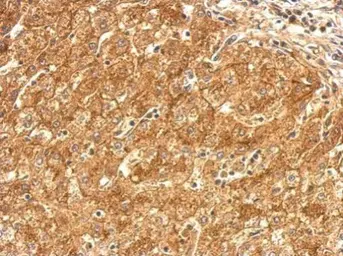 Anti-SR-BI antibody used in IHC (Paraffin sections) (IHC-P). GTX113645