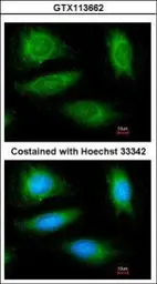 Anti-CYLD antibody [N1N2], N-term used in Immunocytochemistry/ Immunofluorescence (ICC/IF). GTX113662
