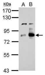 Anti-Cortactin antibody used in Western Blot (WB). GTX113681