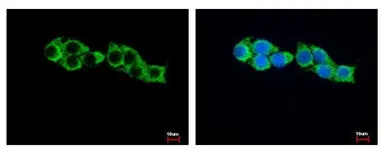 Anti-HADHA antibody [N2C1], Internal used in Immunocytochemistry/ Immunofluorescence (ICC/IF). GTX113727