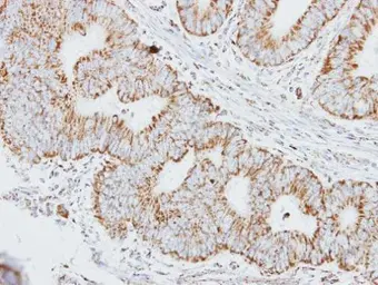 Anti-HADHA antibody [N2C1], Internal used in IHC (Paraffin sections) (IHC-P). GTX113727