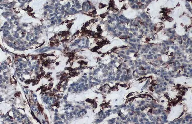 Anti-HLA-DRA antibody [N2C3] used in IHC (Paraffin sections) (IHC-P). GTX113732