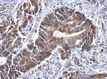 Anti-SDHB antibody used in IHC (Paraffin sections) (IHC-P). GTX113833