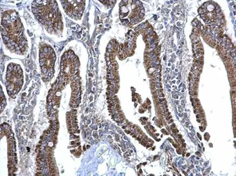 Anti-SDHB antibody used in IHC (Paraffin sections) (IHC-P). GTX113833