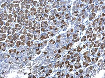 Anti-SDHB antibody used in IHC (Paraffin sections) (IHC-P). GTX113833