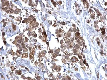 Anti-SDHB antibody used in IHC (Paraffin sections) (IHC-P). GTX113833