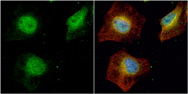 Anti-SET antibody used in Immunocytochemistry/ Immunofluorescence (ICC/IF). GTX113834
