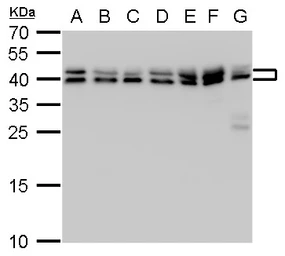 Anti-SET antibody used in Western Blot (WB). GTX113834