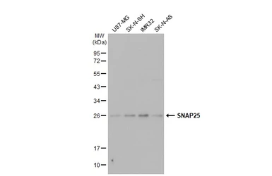 Anti-SNAP25 antibody used in Western Blot (WB). GTX113839