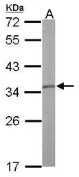 Anti-Tropomyosin 1 antibody used in Western Blot (WB). GTX113857