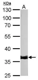 Anti-Tropomyosin 1 antibody used in Western Blot (WB). GTX113857