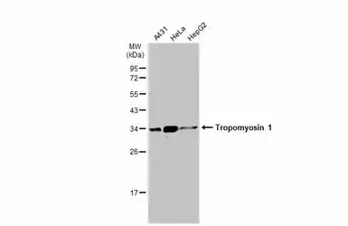Anti-Tropomyosin 1 antibody used in Western Blot (WB). GTX113857