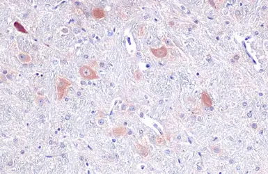 Anti-Tryptophanyl tRNA synthetase antibody used in IHC (Paraffin sections) (IHC-P). GTX113861