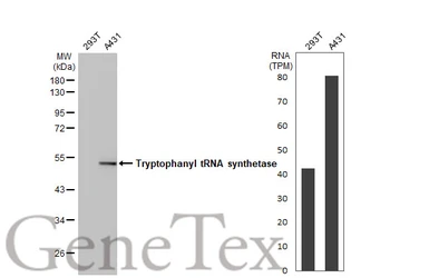 Anti-Tryptophanyl tRNA synthetase antibody used in Western Blot (WB). GTX113861
