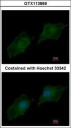 Anti-SRC3 antibody [N1N2], N-term used in Immunocytochemistry/ Immunofluorescence (ICC/IF). GTX113869