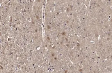 Anti-NOL3 antibody used in IHC (Paraffin sections) (IHC-P). GTX113889