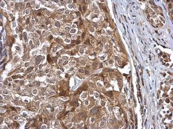 Anti-Cullin 7 antibody [C2C3], C-term used in IHC (Paraffin sections) (IHC-P). GTX113906