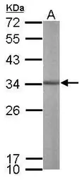 Anti-ALY antibody used in Western Blot (WB). GTX113917