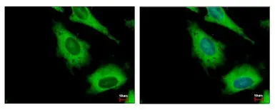 Anti-IGF2BP2 antibody used in Immunocytochemistry/ Immunofluorescence (ICC/IF). GTX113922