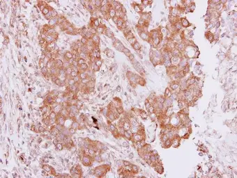 Anti-PIM2 antibody used in IHC (Paraffin sections) (IHC-P). GTX113928