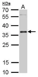 Anti-PIM2 antibody used in Western Blot (WB). GTX113928