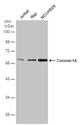 Anti-Coronin 1A antibody [N1N3] used in Western Blot (WB). GTX113931