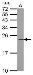 Anti-Calcium binding protein p22 antibody used in Western Blot (WB). GTX113936