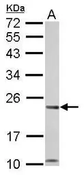 Anti-Calcium binding protein p22 antibody used in Western Blot (WB). GTX113936