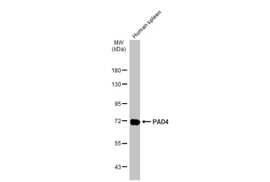Anti-PAD4 antibody used in Western Blot (WB). GTX113945