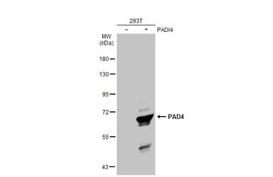 Anti-PAD4 antibody used in Western Blot (WB). GTX113945