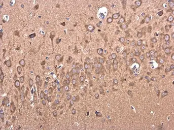 Anti-BACE2 antibody [C1C3] used in IHC (Paraffin sections) (IHC-P). GTX113951