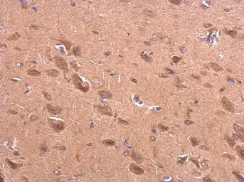 Anti-BACE2 antibody [C1C3] used in IHC (Paraffin sections) (IHC-P). GTX113951