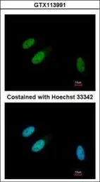 Anti-TRIB3 antibody [N3C3] used in Immunocytochemistry/ Immunofluorescence (ICC/IF). GTX113991