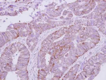 Anti-ATP6V1E1 antibody used in IHC (Paraffin sections) (IHC-P). GTX114056