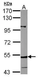 Anti-CYP27A1 antibody used in Western Blot (WB). GTX114065